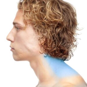 Cuello Posterior (S)